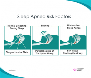 sleep apnea techniques