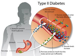 traveling with diabetes