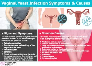 yeast infection