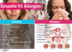 sinusitis