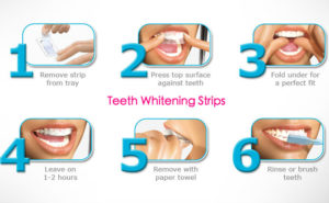 Whitening Treatments