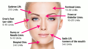 botox treatment