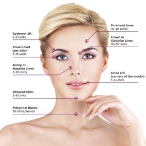 botox treatment