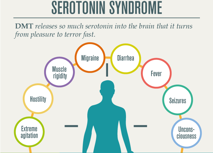 migraines