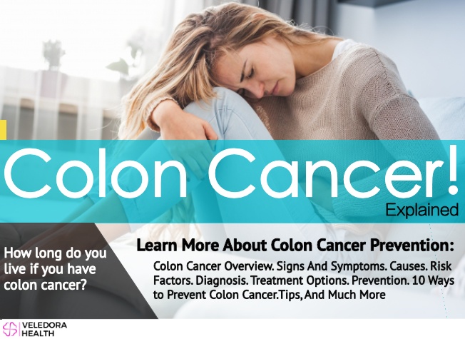 colon cancer