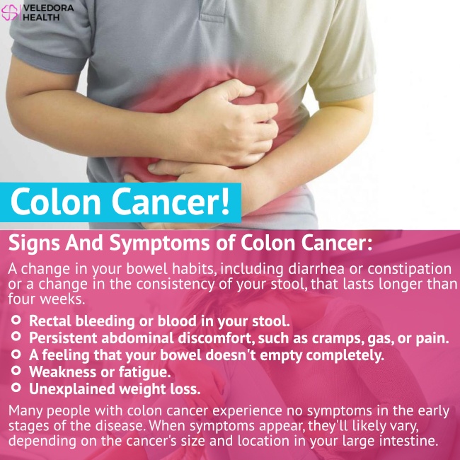 Colon Cancer Causes, Symptoms And Treatment! - Veledora Health