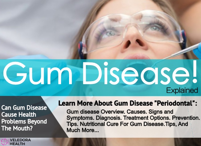 Gum disease