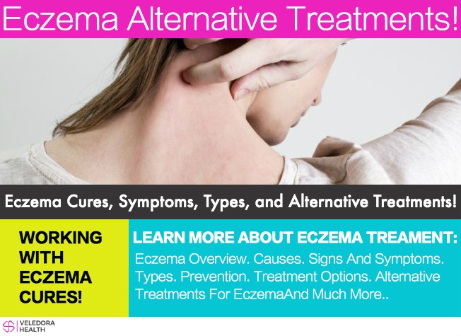 eczema