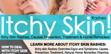 ITCHY SKIN