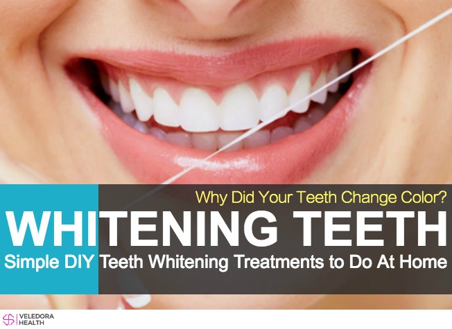 Whitening Treatments