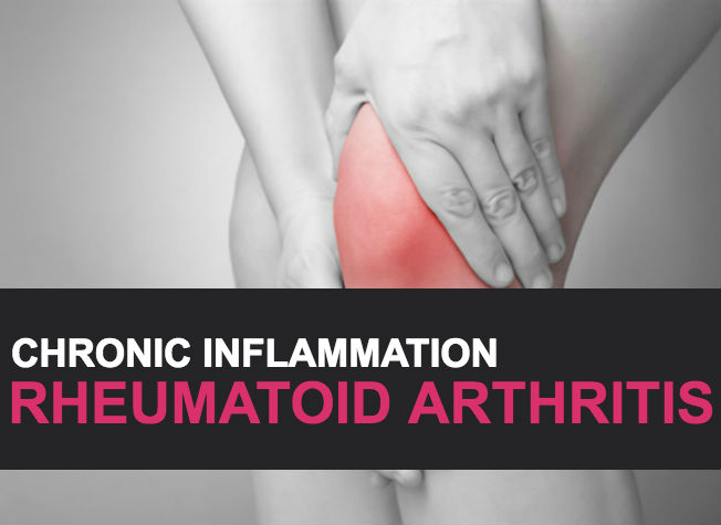 Chronic Inflammation