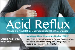 Managing Heartburn And Acid Reflux Disease “GERD”!