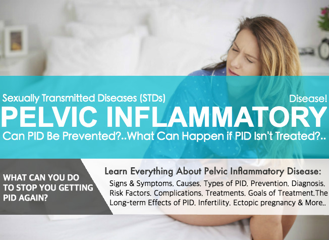 pelvic inflammatory