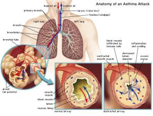 Reduce Asthma Allergy