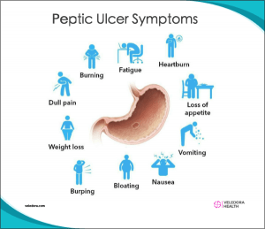 peptic ulcer