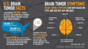 brain tumor