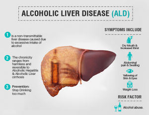 fatty liver disease