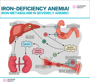 Iron-Deficiency Anemia