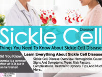 sickle cell disease