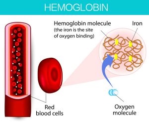 iron-deficiency anemia