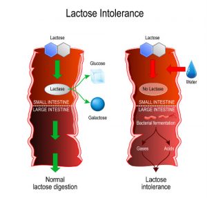 manage lactose intolerance