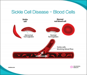 Sickle Cell Disease