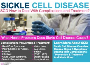 Sickle Cell Disease