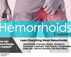 Hemorrhoids, Causes, Symptoms And Treatment!