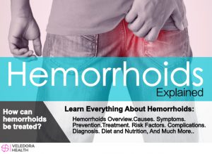 hemorrhoids 