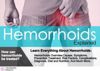 Hemorrhoids, Causes, Symptoms And Treatment!