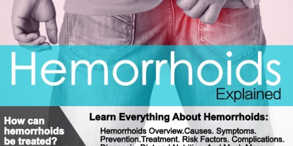 Hemorrhoids, Causes, Symptoms And Treatment!