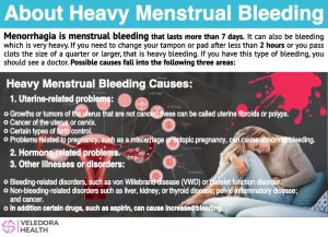 menstrual bleeding