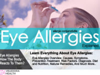 eye allergies