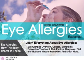 Eye Allergies, Treatment Options, And Management!