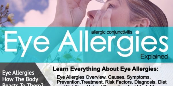 Eye Allergies, Treatment Options, And Management!