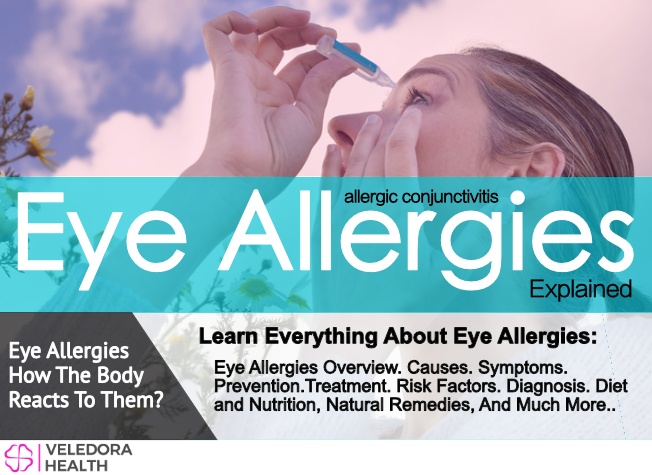 eye allergies