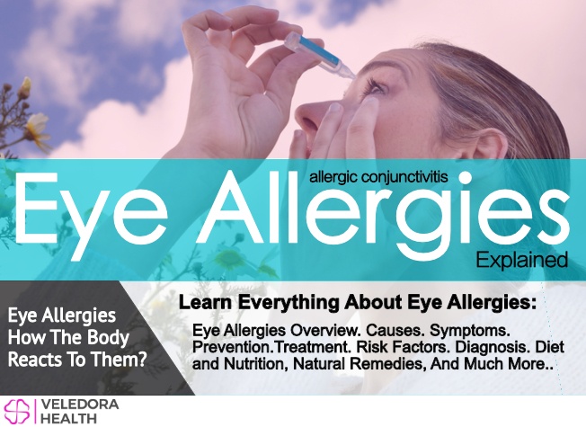 eye allergies