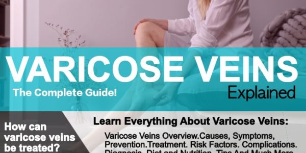 Varicose Veins Causes Symptoms, and treatment!
