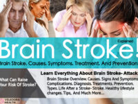 Brain Stroke