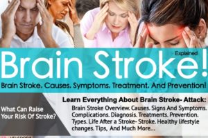 Brain Stroke, How to Prevent Brain Stroke!