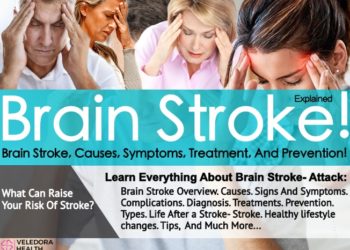 Brain Stroke, How to Prevent Brain Stroke!