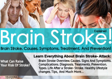Brain Stroke