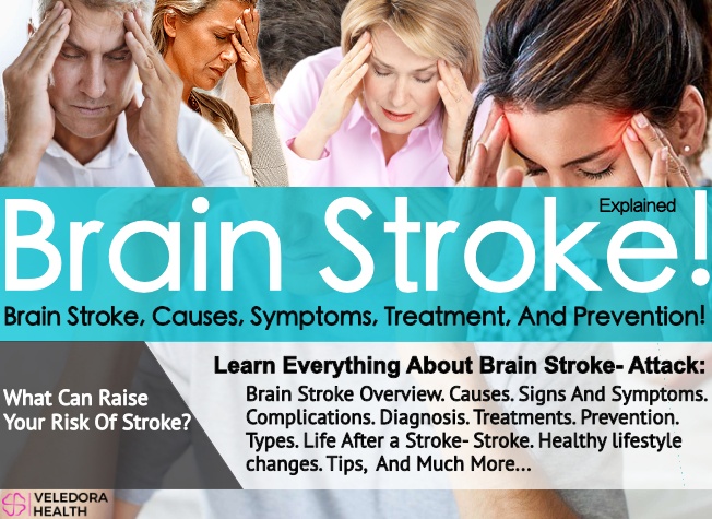 Brain Stroke