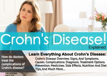 Crohn’s Disease, Early Signs, Causes, Treatment And Diet!