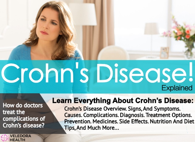 Crohn's disease