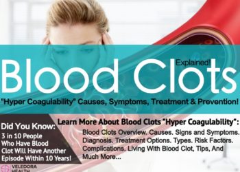 Blood Clots, Risks, Symptoms And Prevention!