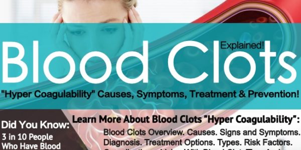 Blood Clots, Risks, Symptoms And Prevention!